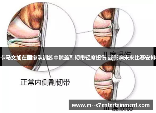 卡马文加在国家队训练中膝盖副韧带轻度扭伤 或影响未来比赛安排 卡马文加在国家队训练中膝盖副韧带轻度扭伤 或影响未来比赛安排